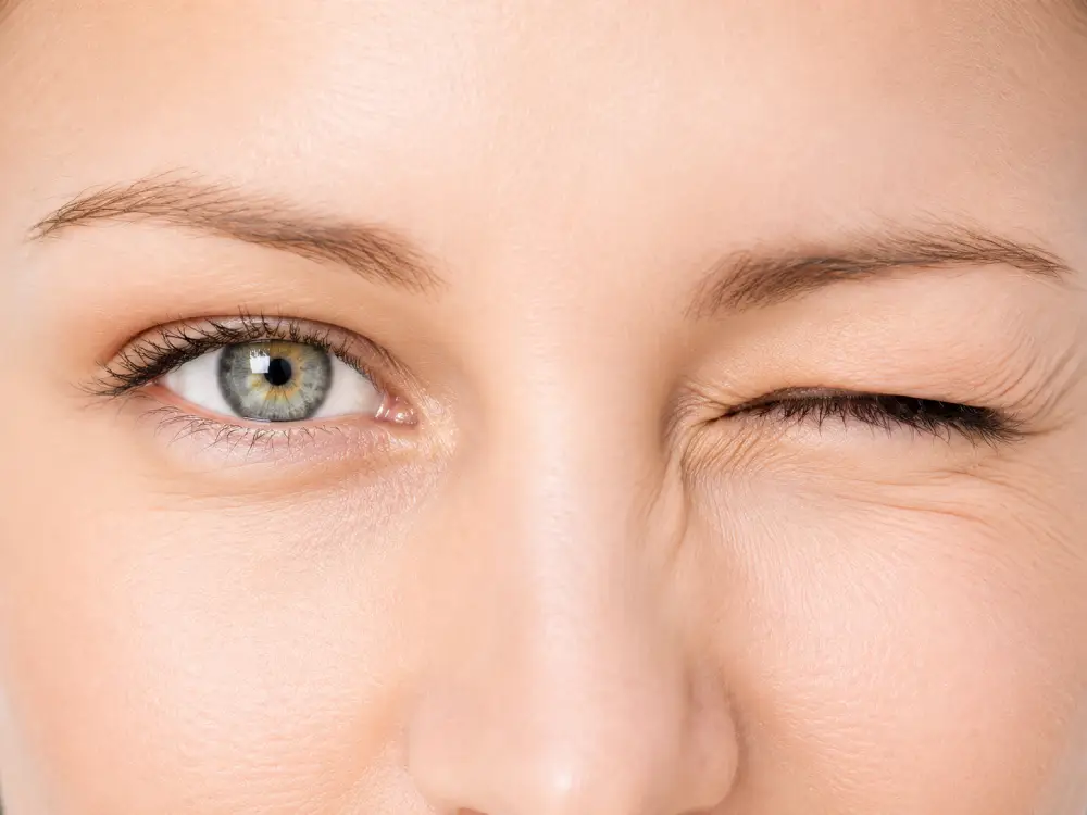 Blepharospasm