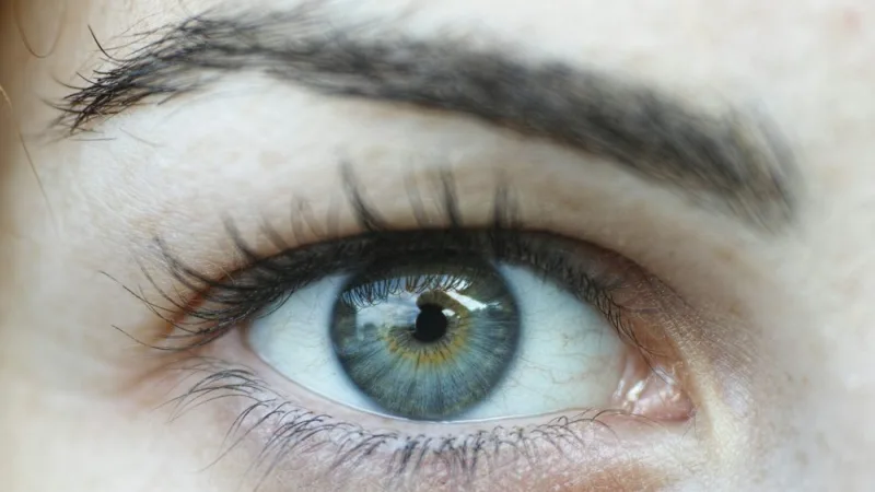 Dermatochalasis (Hooded Eyelids)