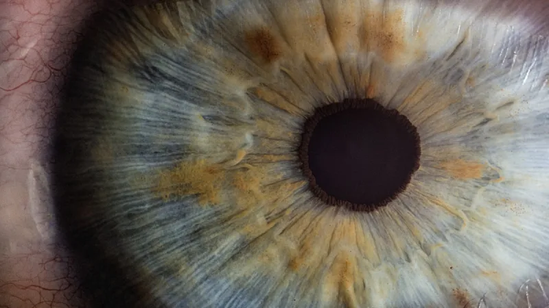 Medical Retina