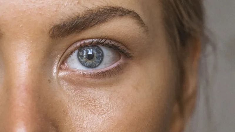 Periocular Lumps, Bumps & Skin Tags