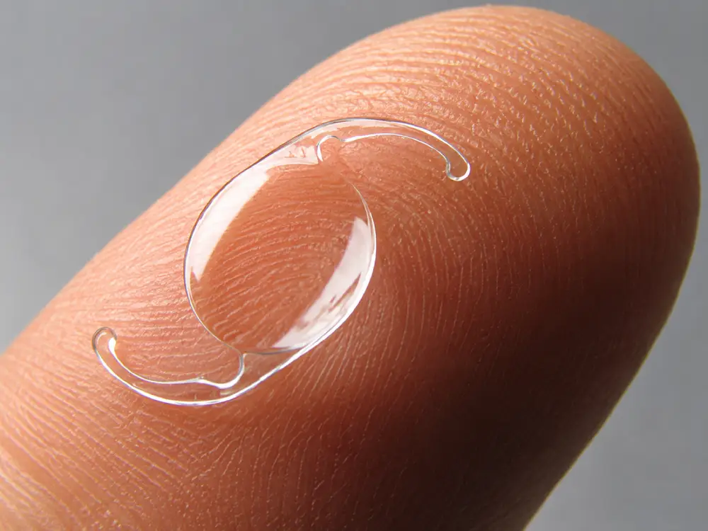 Refractive lens exchange